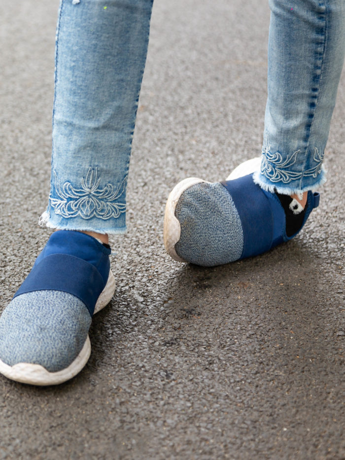Sprained Ankle, When to Call the Pediatrician