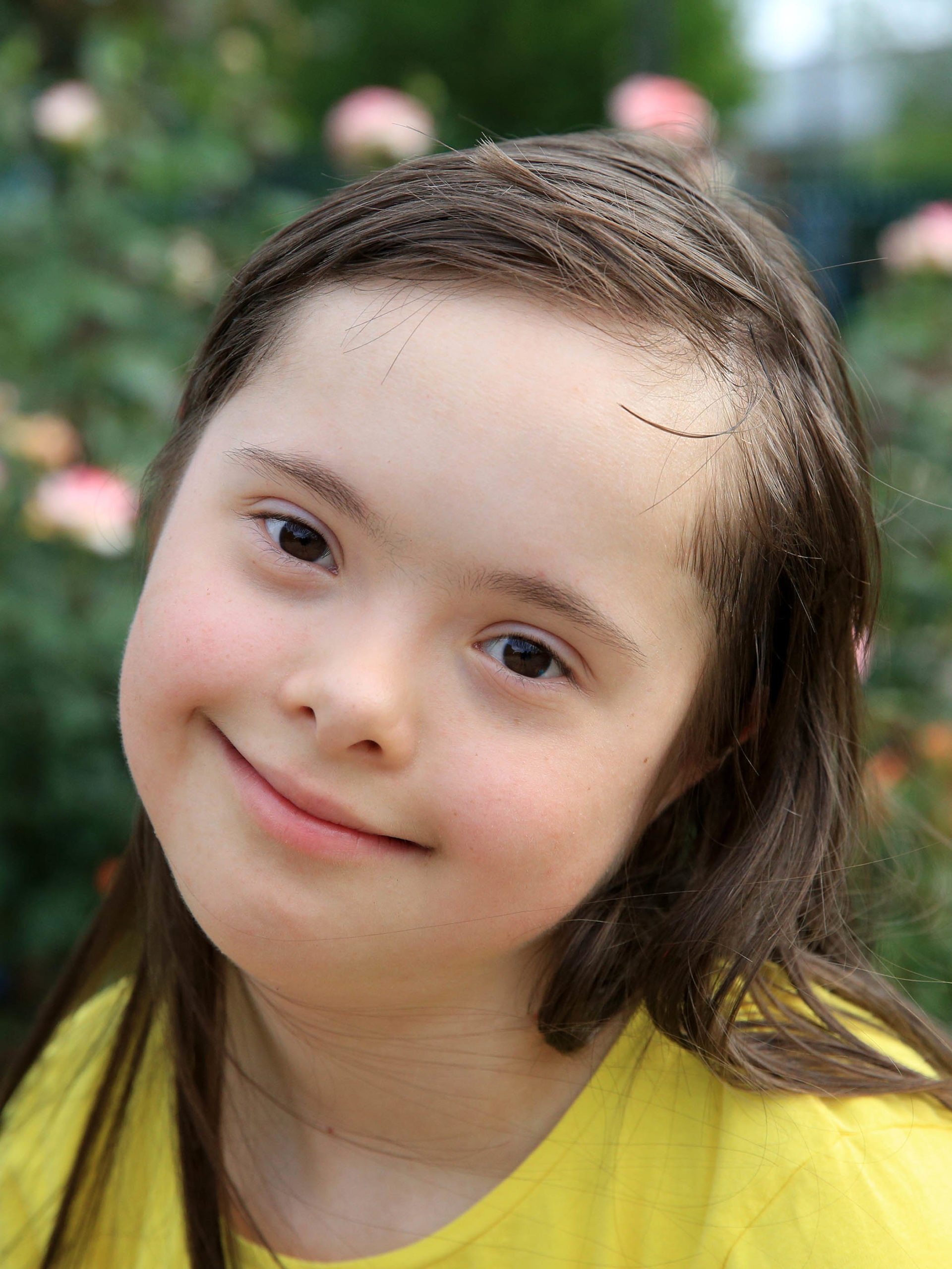 young girl with down syndrome