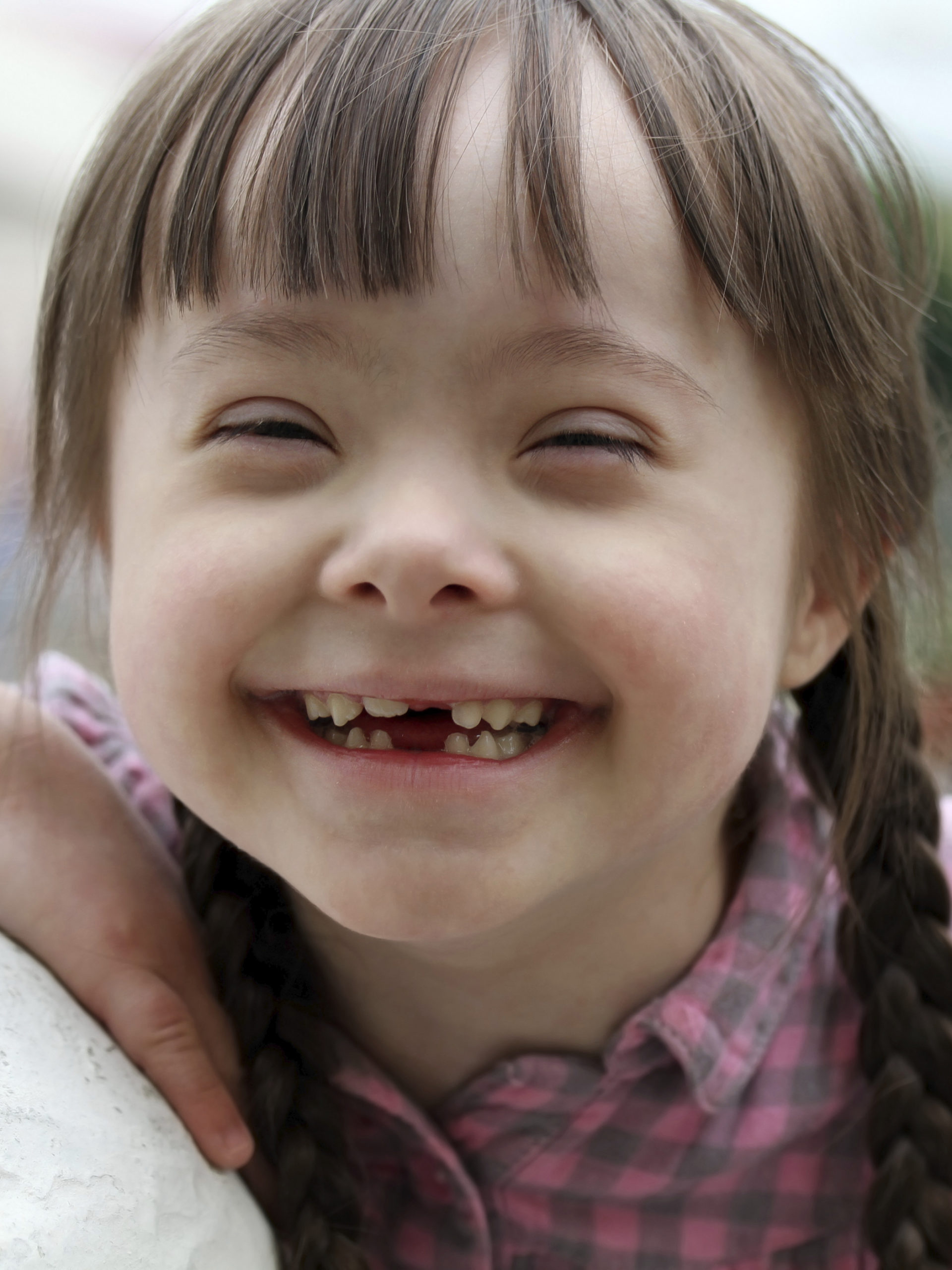 Portrait of young happy girl with down syndrome