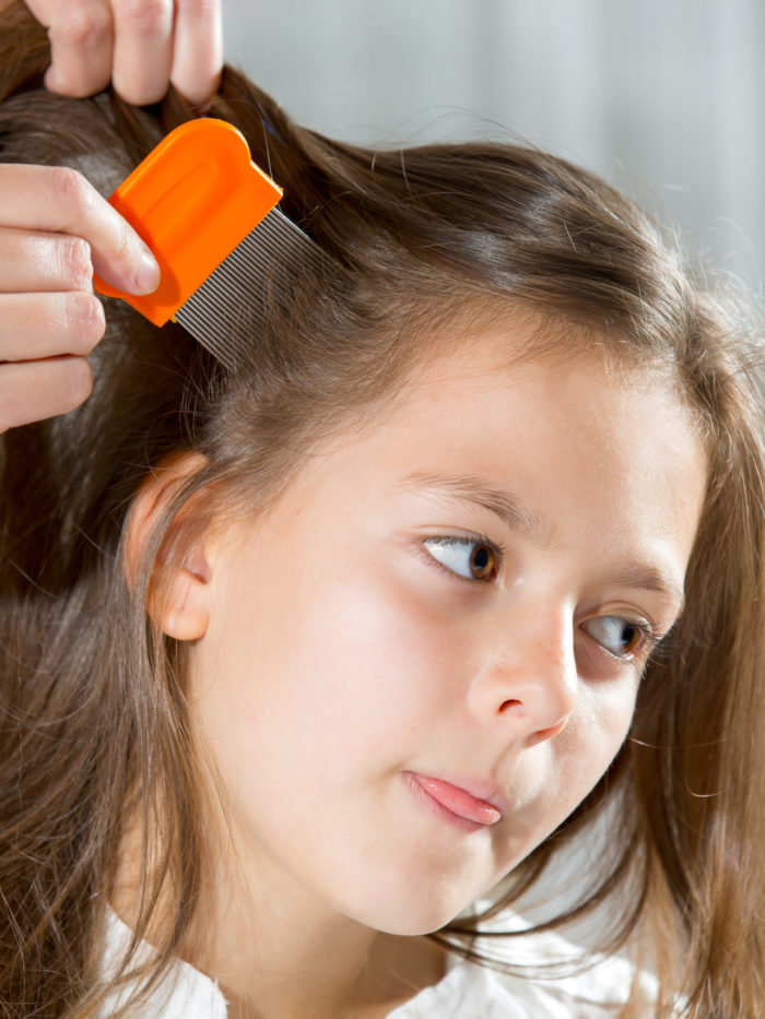 lice removal tips