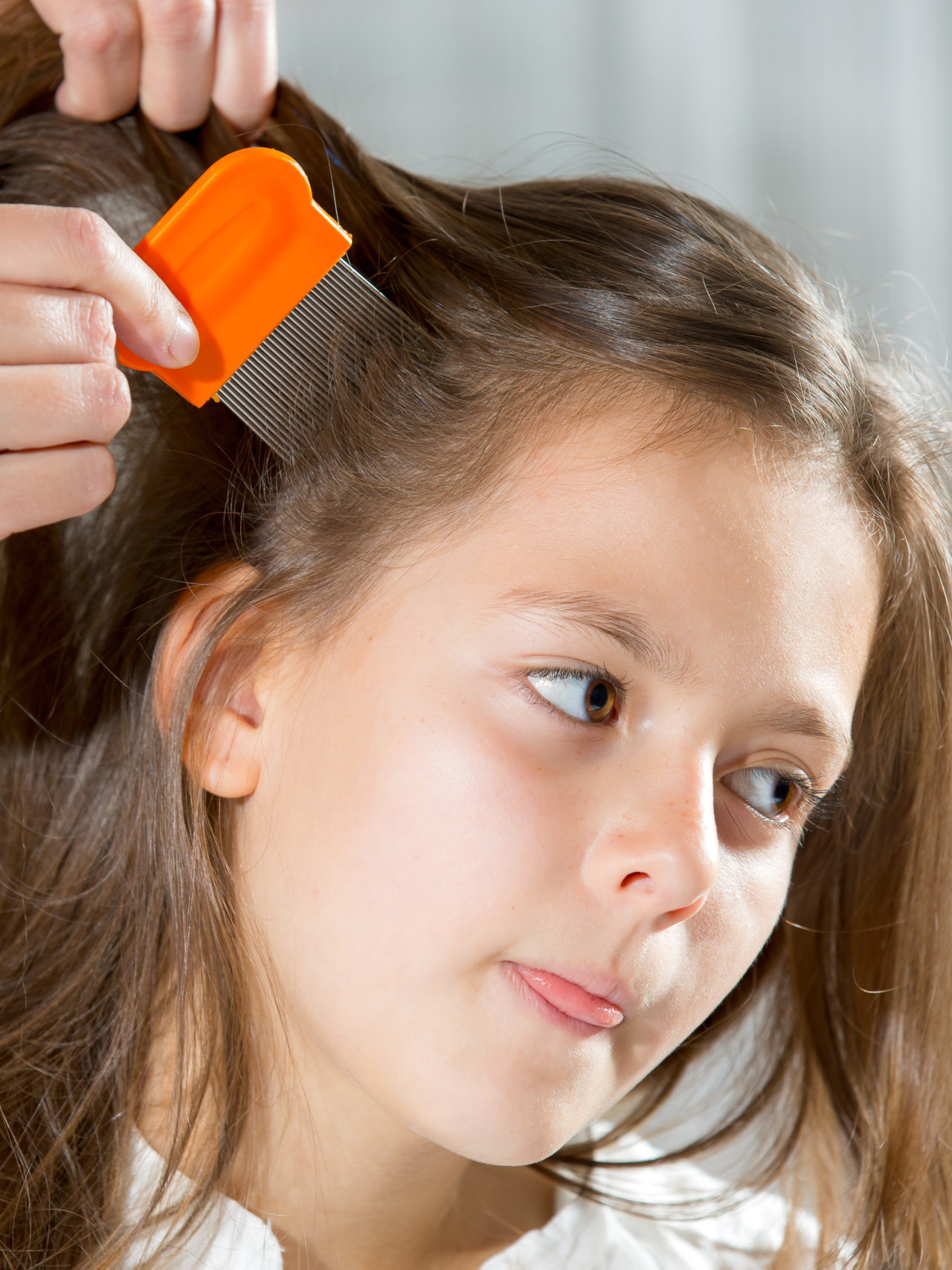 Lice Removal Tips in Time for Back to School Season - CHOC - Children's  health hub