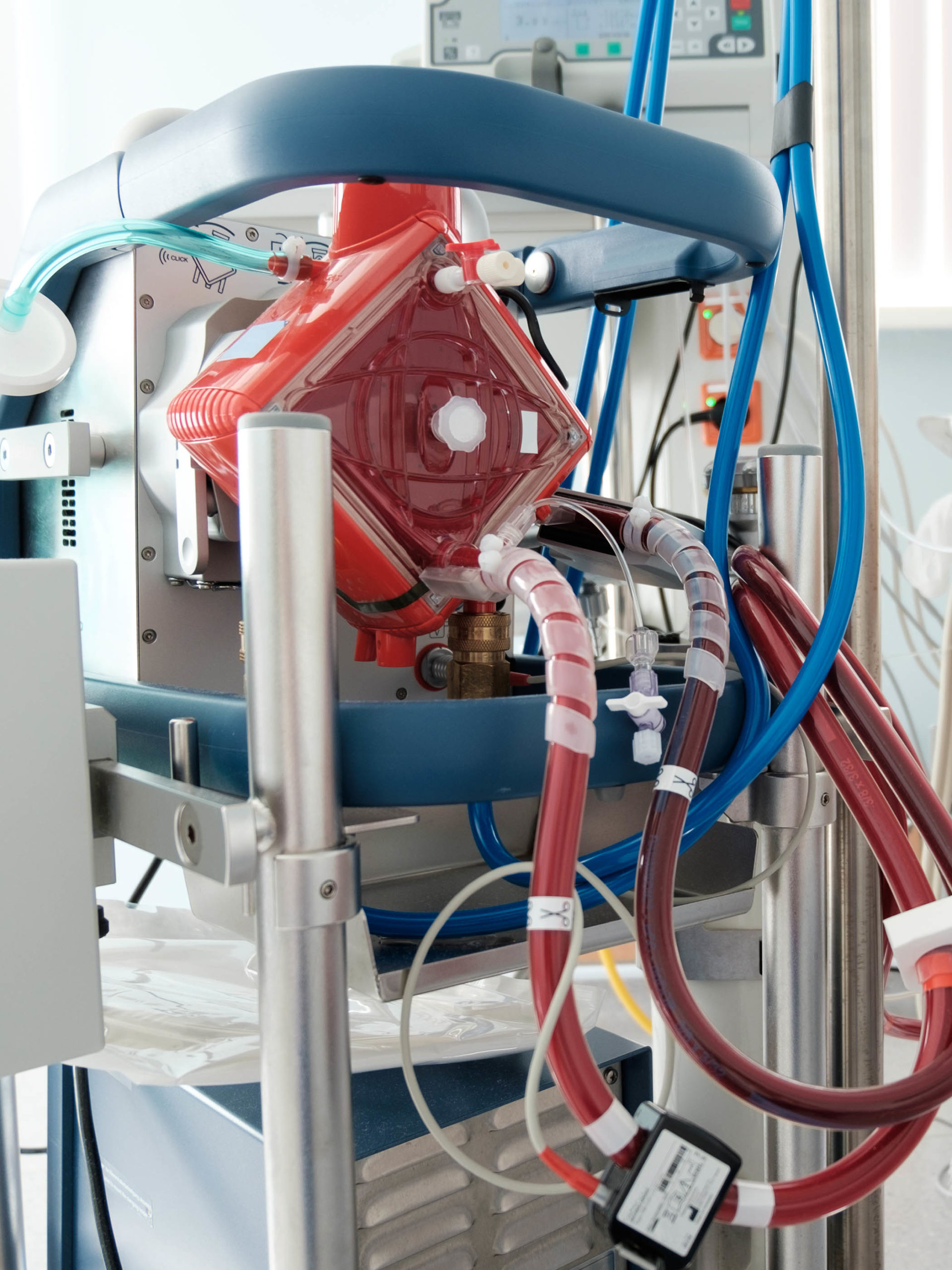 ECMO machine in intensive care department