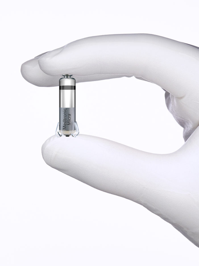 CHOC Patient Benefits from World’s Smallest Pacemaker