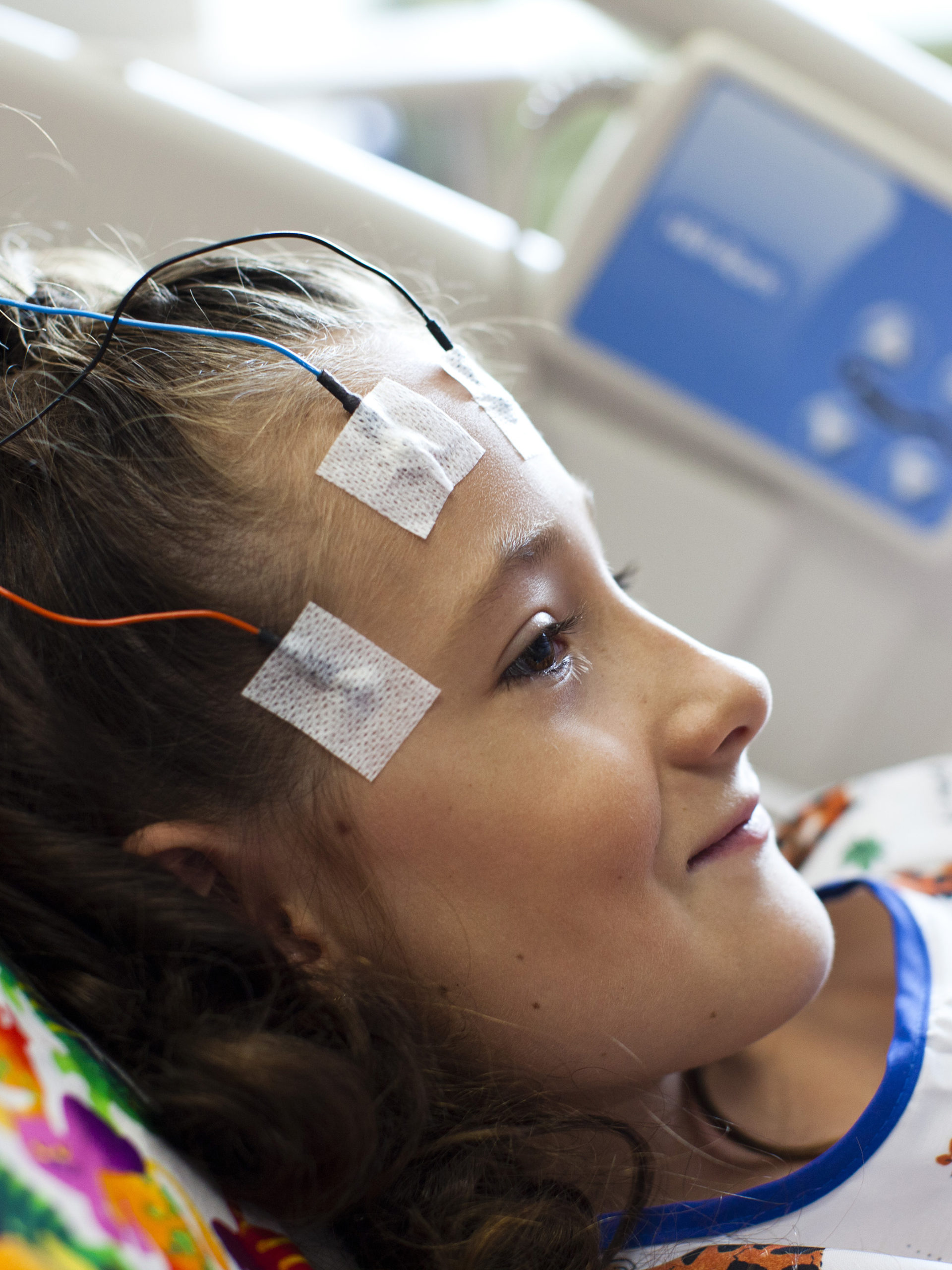 EEG monitoring a young girl at CHOC children's hospital