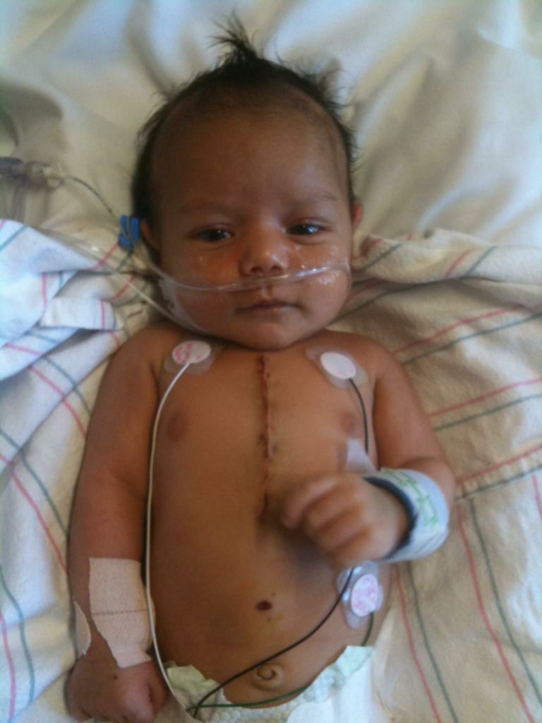 Tetralogy of Fallot Patient and his Family Give Back