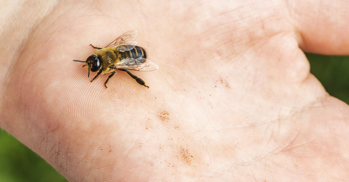 honey bee sting allergy