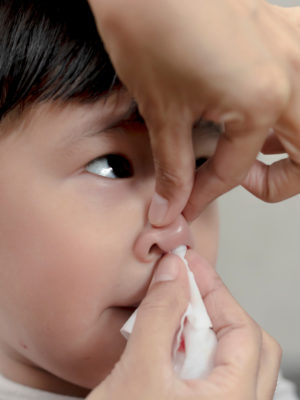 Mom helping child stop nosebleed