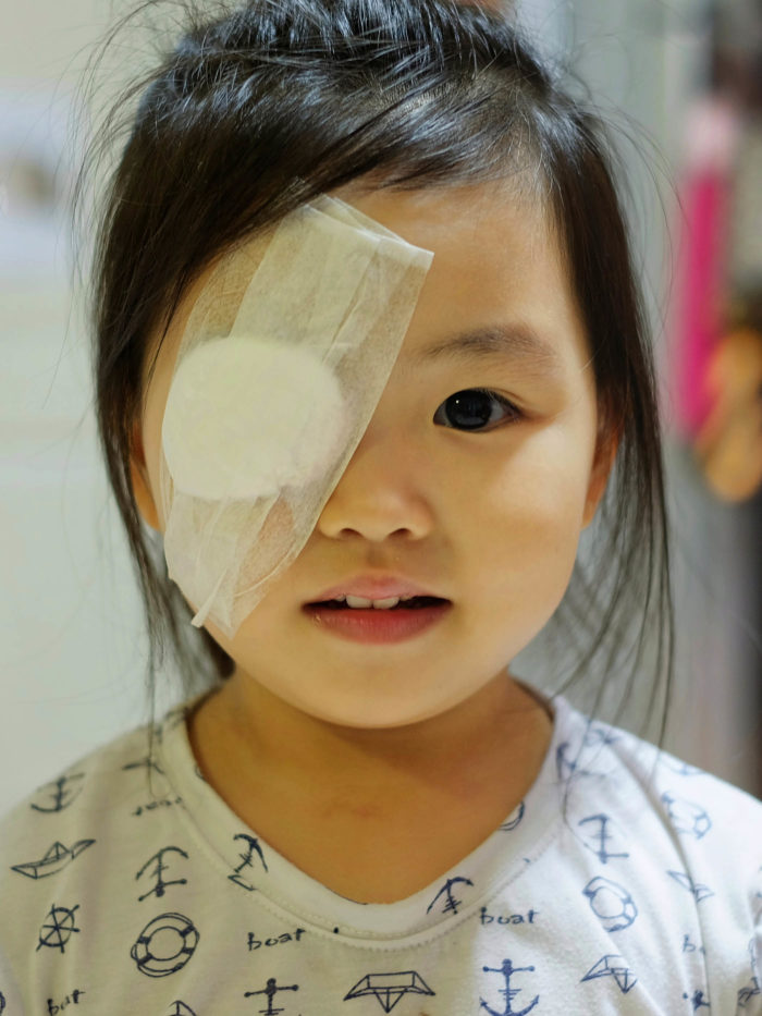girl with on eye covered with white plaster after surgery