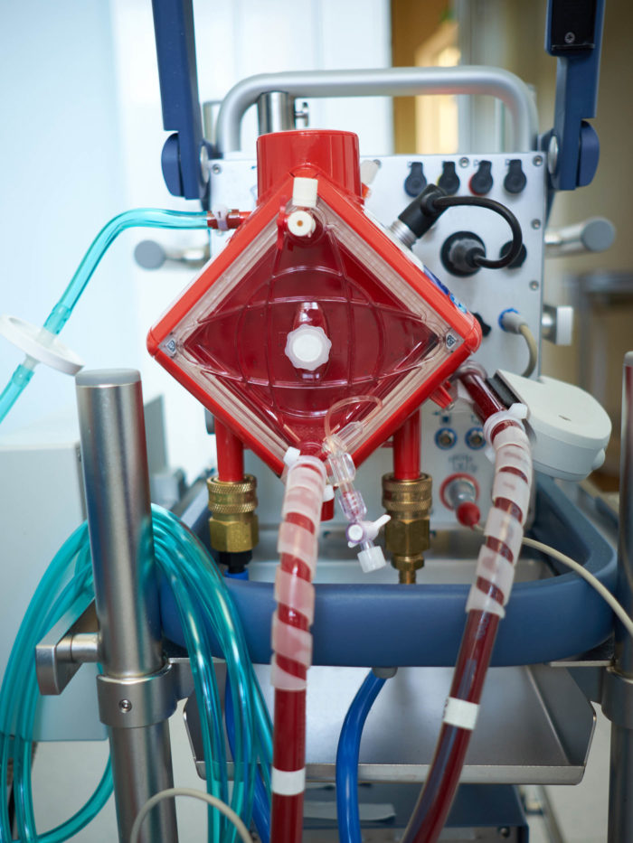 How ECMO Can Save a Child’s Life