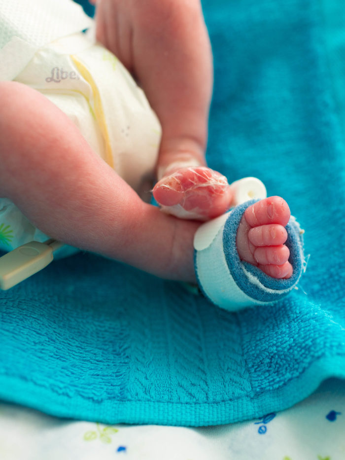 neonatal infant pulse oximeter for premature babies on baby foot