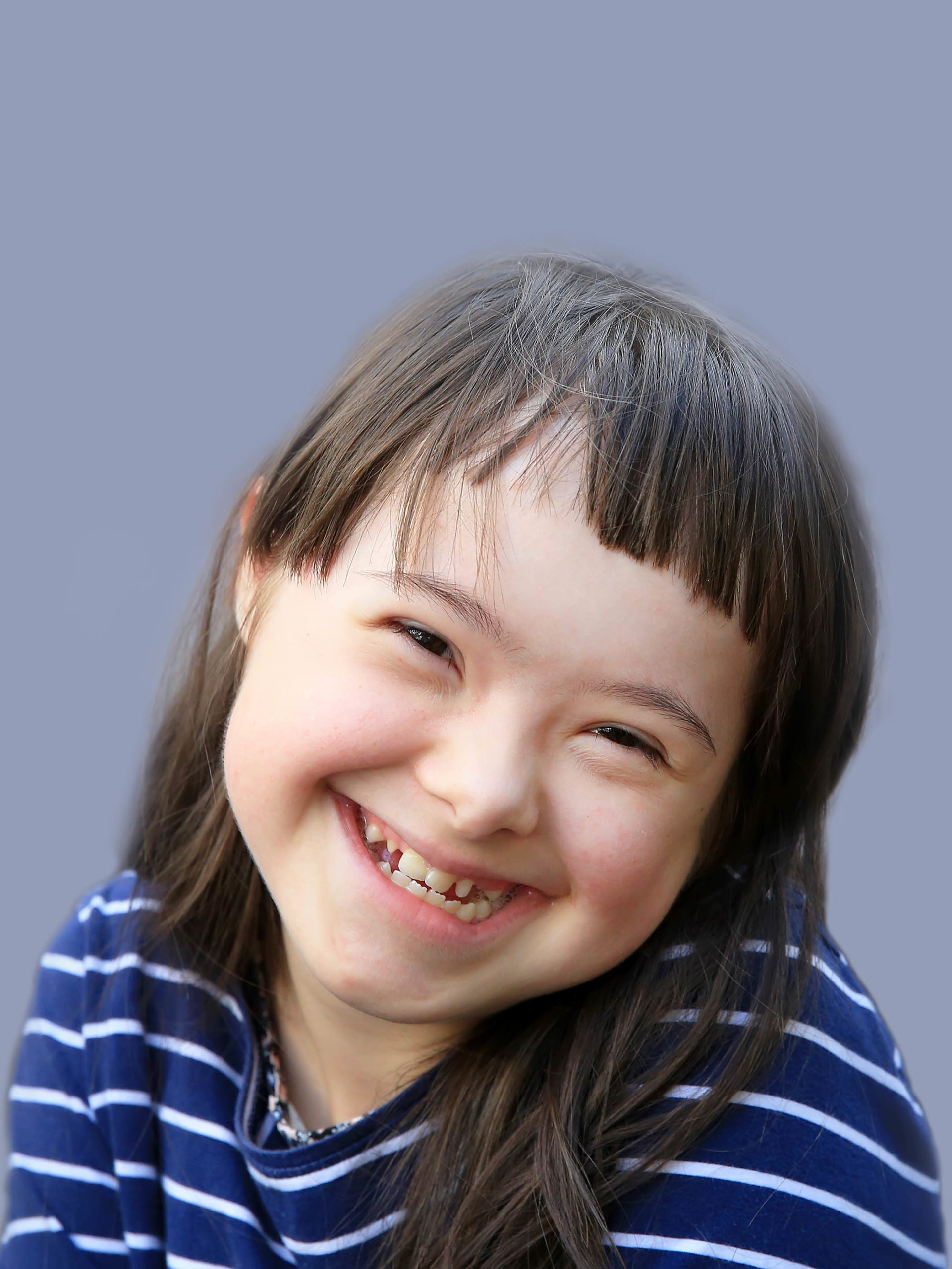 portrait of cute smiling girl with down syndrome