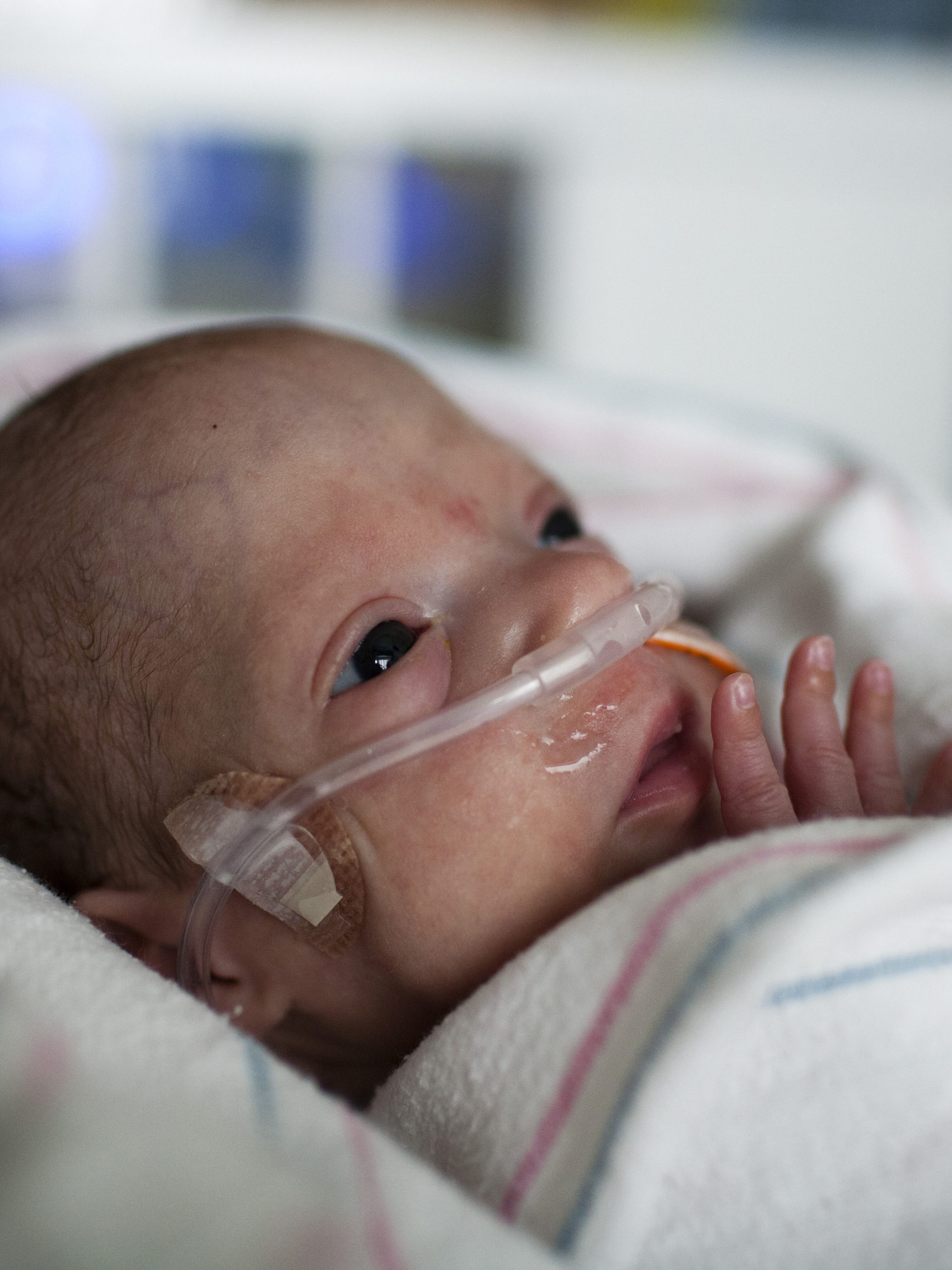 Tiny baby in the NICU with oxygen tube
