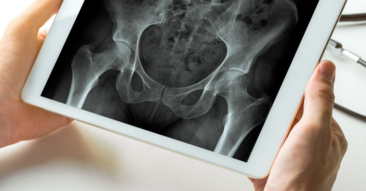 Meet Dr. Francois Lalonde, a board certified pediatric orthopaedic surgeon