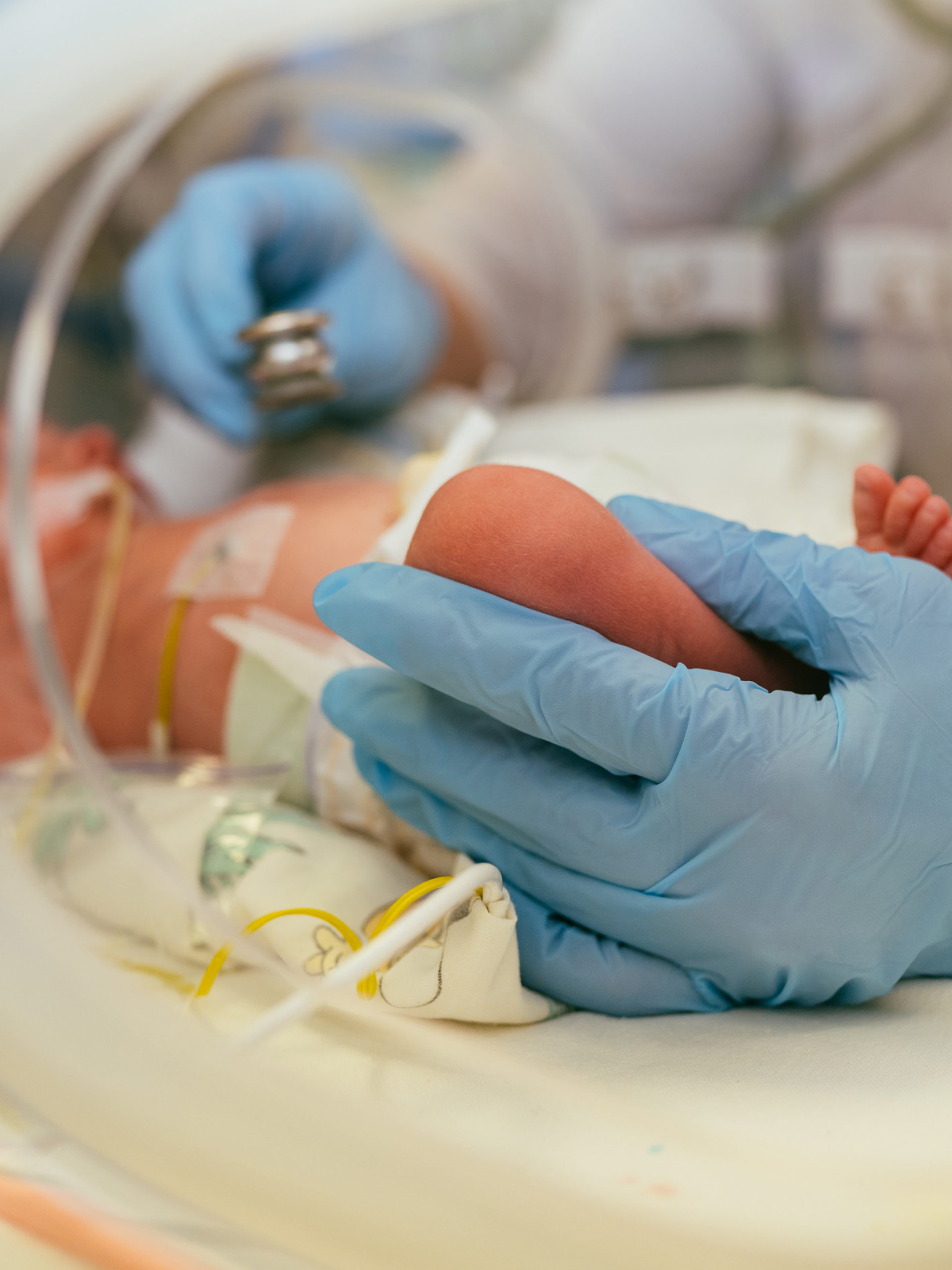 newborn baby in intensive care unit in a medical incubator