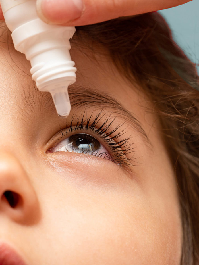 Tips to Make Eye Drops Easier for Kids – and Parents