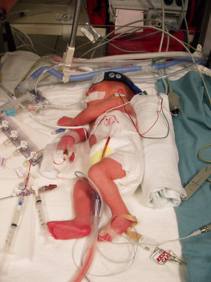 Baby with wires laying in hospital bed