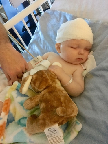 At five months old, Easton bravely underwent cranial vault remodeling surgery.