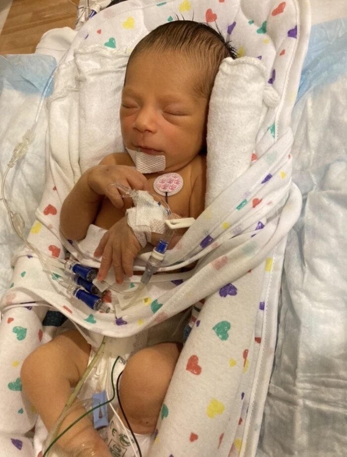 Chase faced early surgery and an ostomy due to Hirschsprung’s disease.